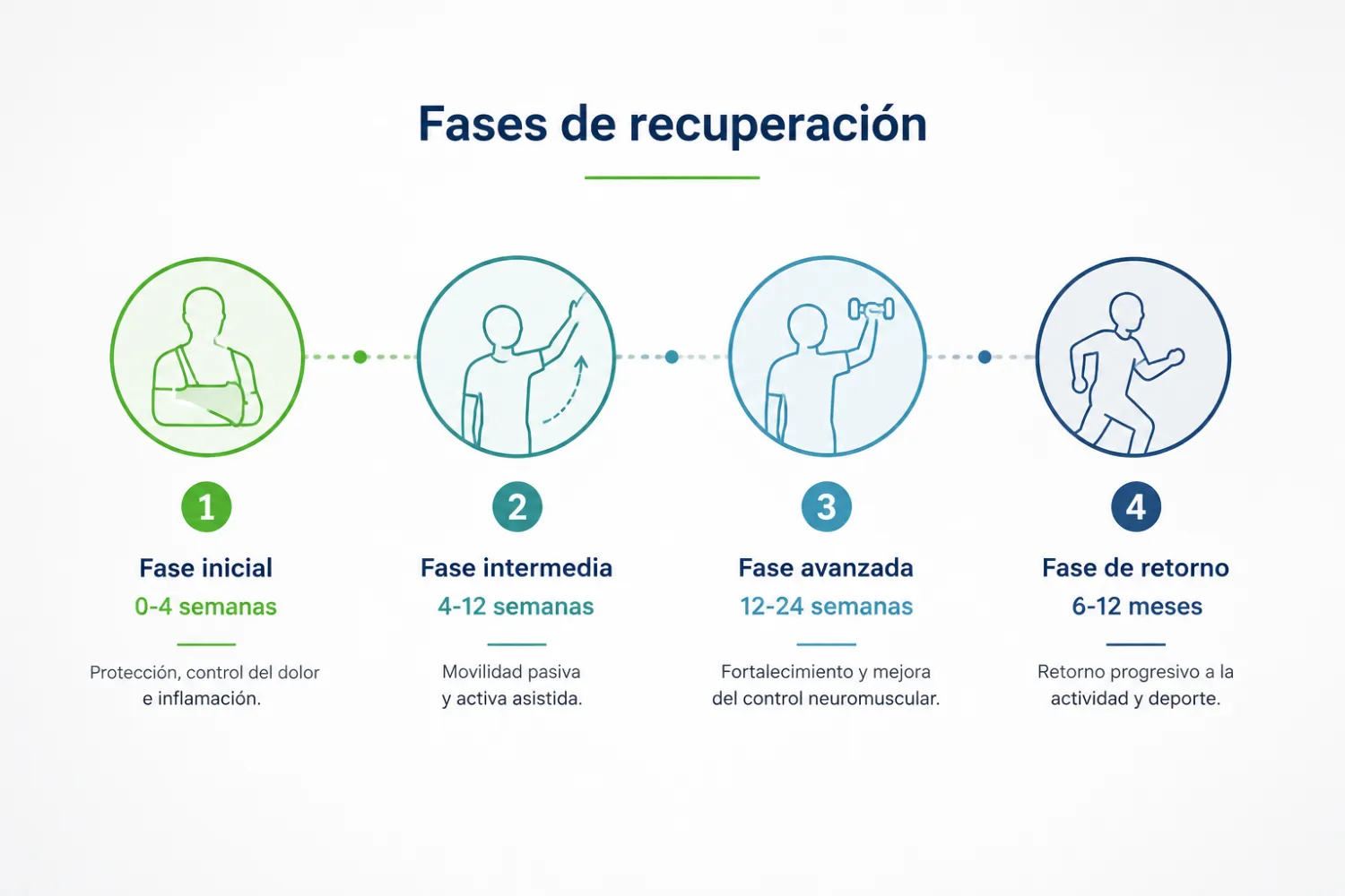 Infografía de las 4 fases de recuperación del hombro: inicial, intermedia, avanzada y de retorno